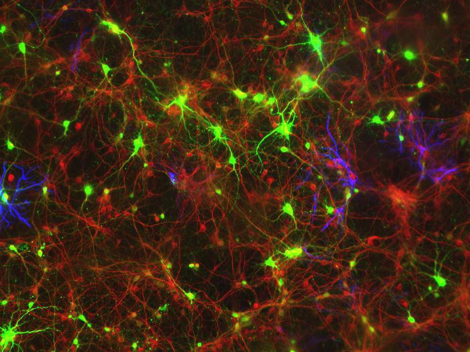 NEPA21 / Primary - Mouse Cerebral Cortex Neurons - Viability 80 per cent
